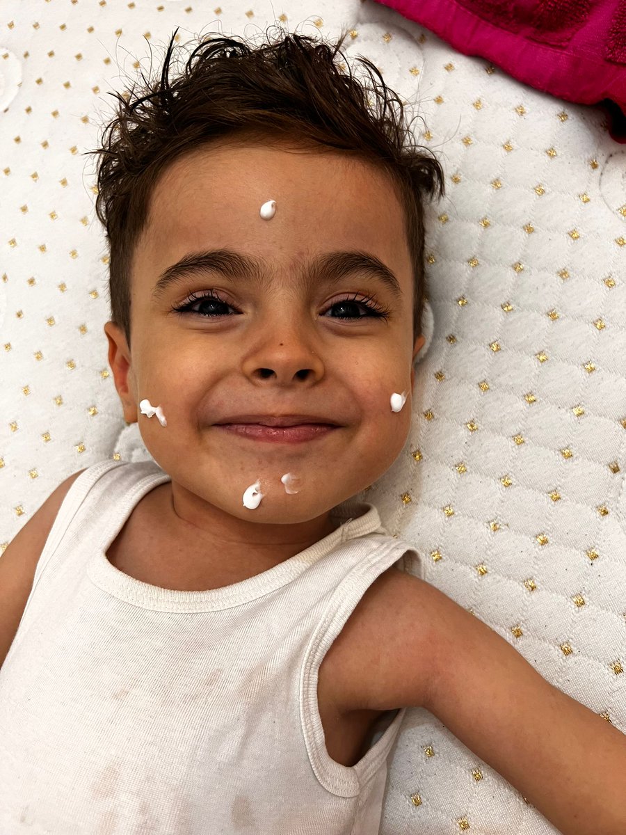 İYİKİİİ DOĞDUNNNN ALPERRRR KUŞŞŞŞ 🥳💙👑✨🎂🎉🕯️🍰🎁🎈

6. Yaş sana mutluluk ,huzur ve en önemlisi sağlık getirsin minik kuş 💙
6. Yaşına tam da hayâl ettiğimiz gibi Dubai'de zolgensmaya kavuşmaya son adımlar kala giriyorsun 💙

Seni çok seviyoruzzz ALPERRRR 🥳💙🎁🎂