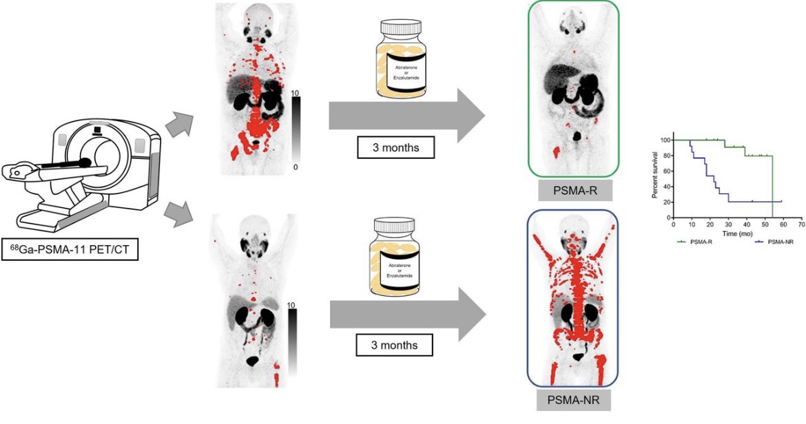 Carlos Artigas (@drcartigas) on Twitter photo Using PSMA for Response Assessment at 3 months of ARPI avoids flair and predicts OS. Check our results just published on <a href="/JournalofNucMed/">JNM</a>. Prospective validation urgently needed. doi.org/10.2967/jnumed…
Great job by our PhD fellow <a href="/q_shagera/">Qaid Shagera, MD, PhD (قايد شاجره)</a> <a href="/JulesBordet/">Institut Jules Bordet Instituut</a> Using PSMA for Response Assessment at 3 months of ARPI avoids flair and predicts OS. Check our results just published on <a href="/JournalofNucMed/">JNM</a>. Prospective validation urgently needed. doi.org/10.2967/jnumed…
Great job by our PhD fellow <a href="/q_shagera/">Qaid Shagera, MD, PhD (قايد شاجره)</a> <a href="/JulesBordet/">Institut Jules Bordet Instituut</a>