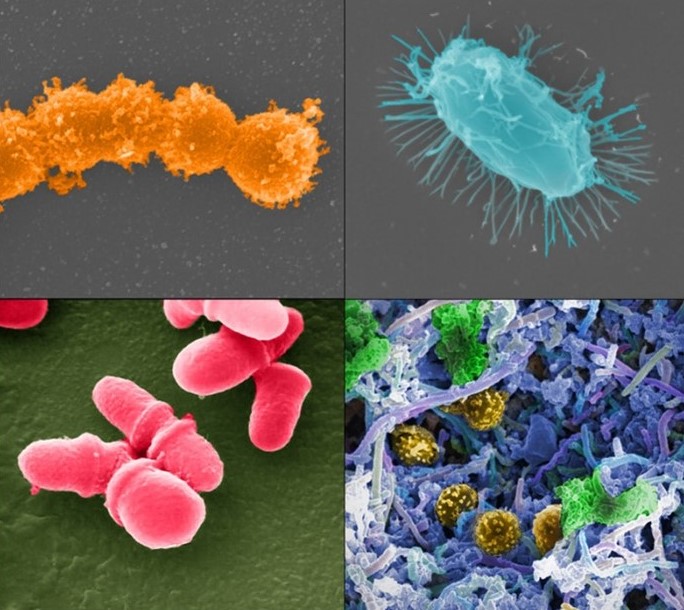 DrBiswasPhdMBA's tweet photo. Our gut health and overall health are profoundly connected. Providing our microbiome with nutrients 🥦🥗🥩 that our bodies appreciate can help us feel better in our digestive and immune resilience 🍽️ #GutHealth #DigestiveWellbeing #microbiome #gut #gutmicrobiom https://t.co/bsMawM4Ndh