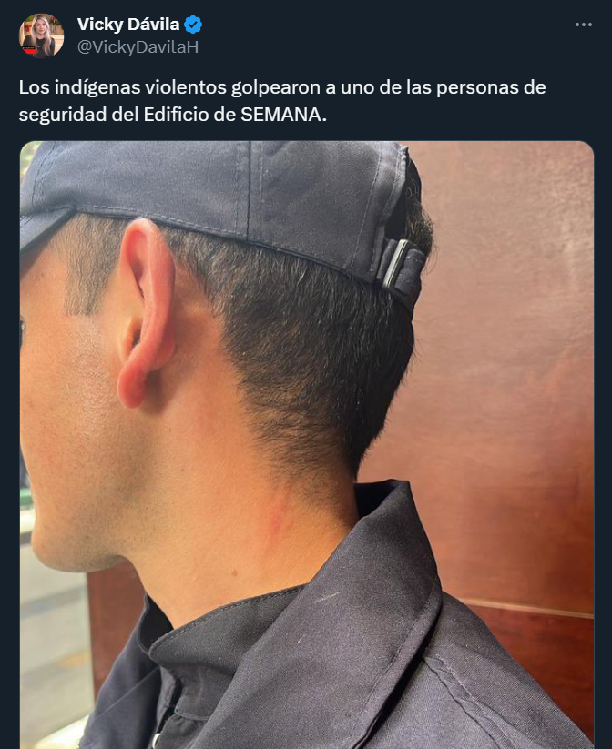 Querida <a href="/VickyDavilaH/">Vicky Dávila</a> para aliviar ese rasguño en el cuello puedes hacer lo siguiente:

Pelar una piña, luego de pelar la piña, coges la cáscara y la pones a cocinar por media hora a fuego lento.

Después vamos a colocarla con la pulpa hacia la piel (no al contrario porque