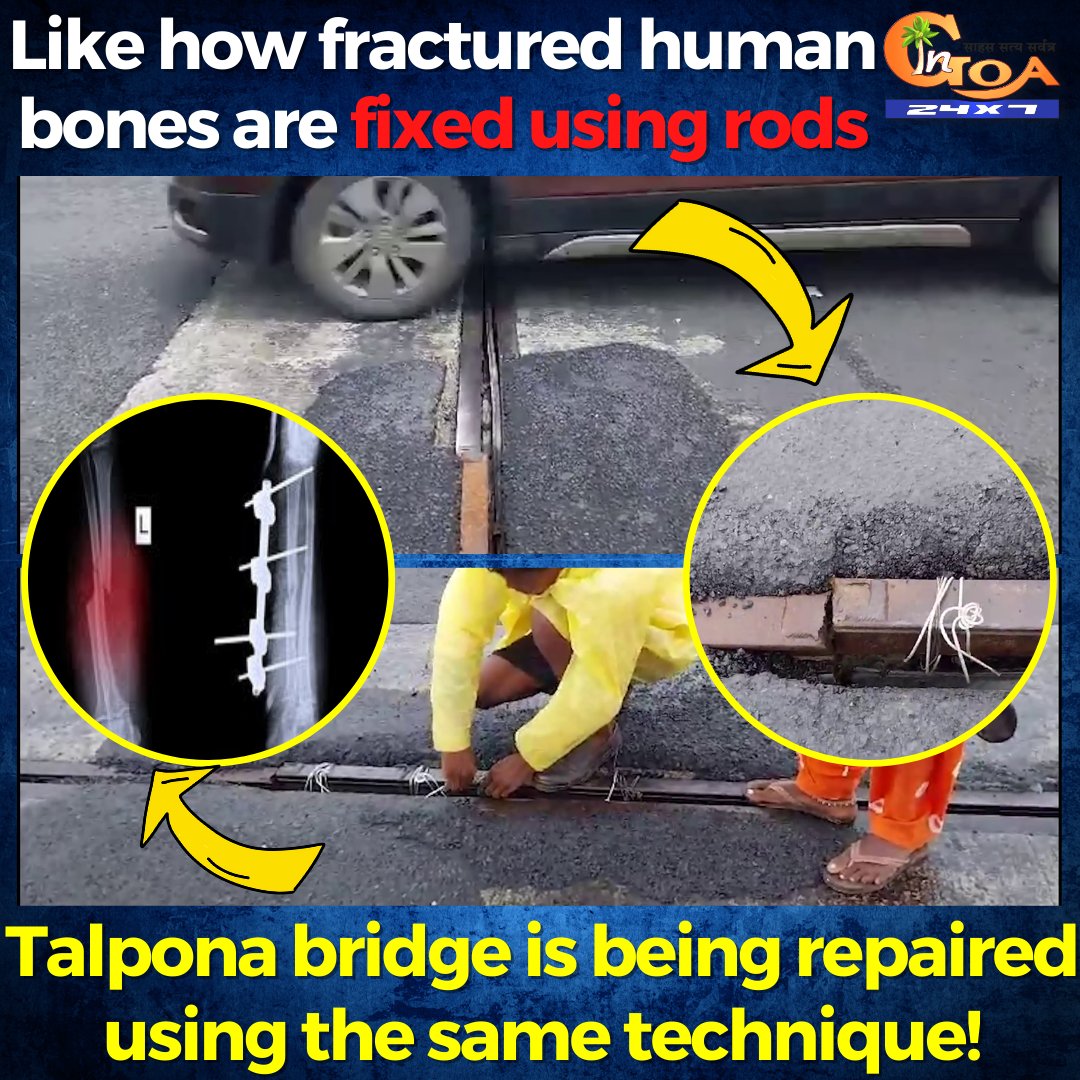 InGoa24x7's tweet photo. Like how fractured human bones are fixed using rods. Talpona bridge is being repaired using the same technique!
WATCH : https://t.co/rIu0LIL9pD

#Goa #Goanews #Human #Rod #Road #Talpona https://t.co/RXPZNshkqq