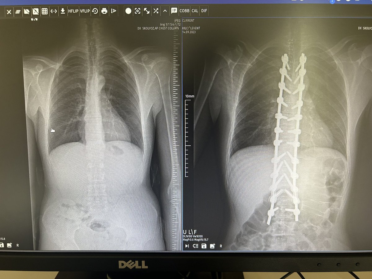 dr_haluk yaka tweet media