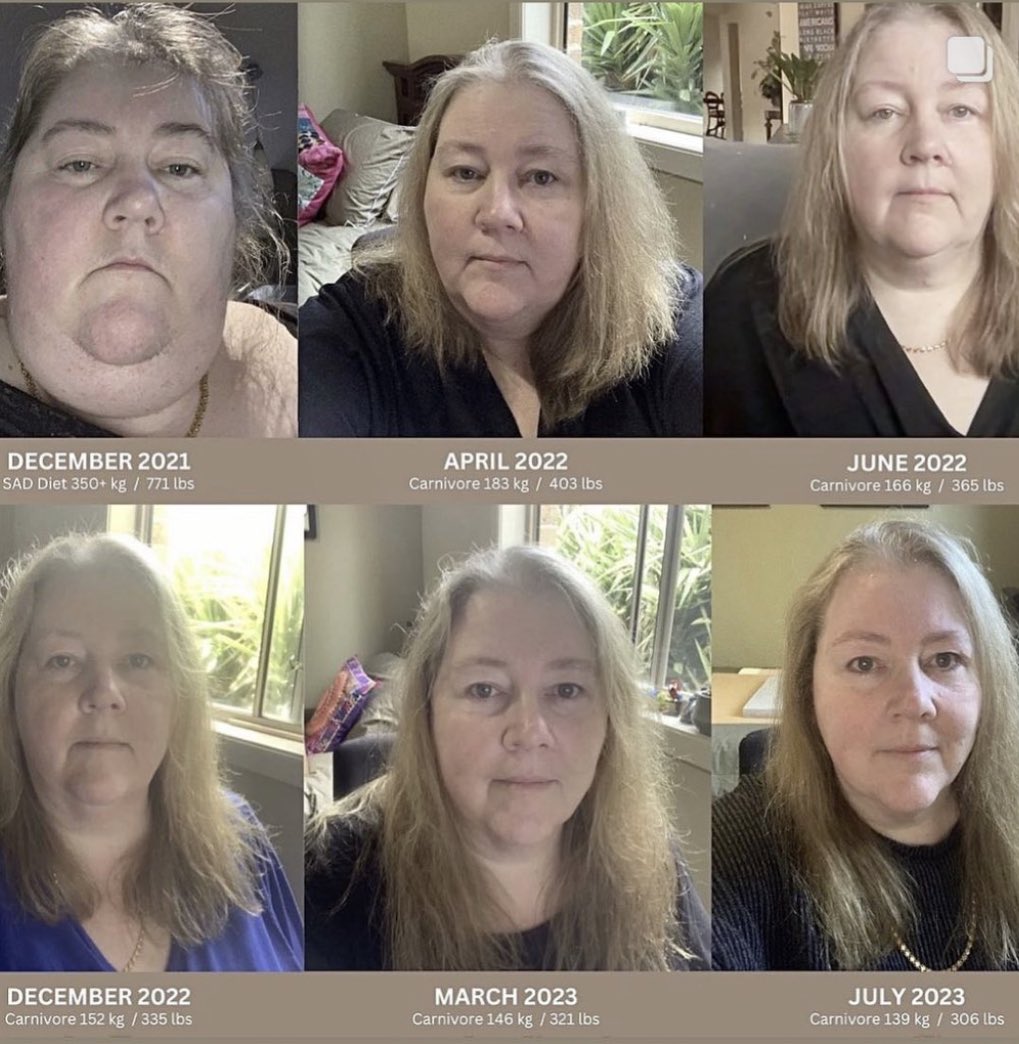 Wow I still can’t believe this! What an incredible journey Lindy has been on. 
Join my inclusive carnivore community to meet others like Lindy!

sbg-s-meat-up.mn.co