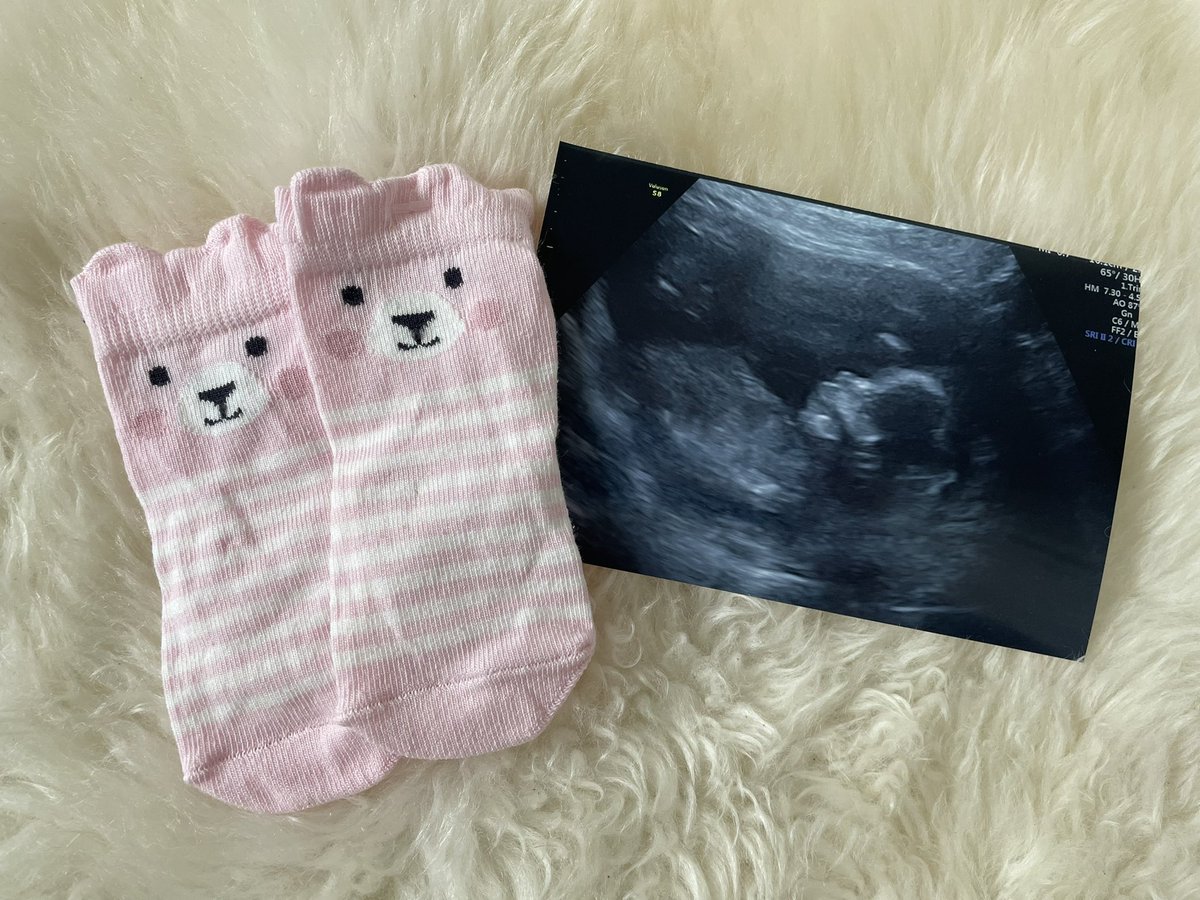 Baby McShee is a girl! 🩷🩷