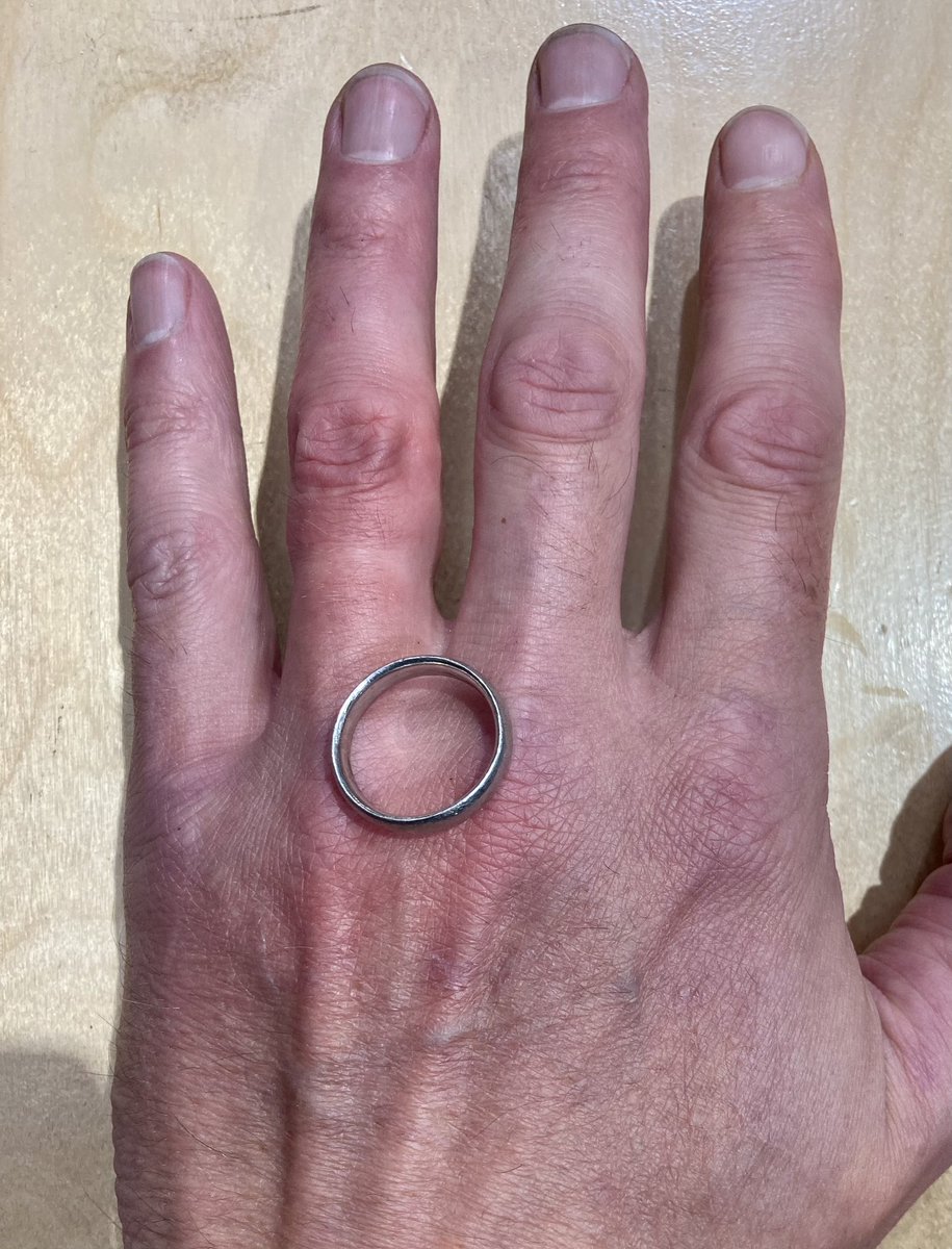 💍 stuck on finger⁉️ Ring tourniquet occurs when a ring becomes entrap... |  Ring | TikTok