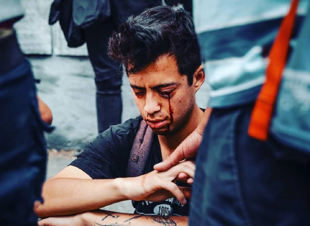 ¿Ustedes entienden por qué les indigna un rasguño de 2 cm en la nuca y no los muchachos a los que les sacaron los ojos con la complicidad de la prensa?

Yo no entiendo, de verdad.

#QueLaPrensaRespeteAlPaís