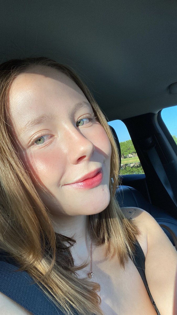 Mi piel gracias a un serum de 300 usd 🤡