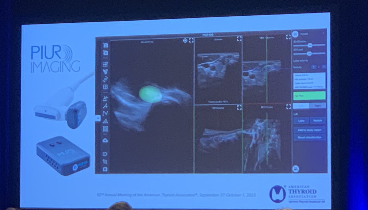 Happening now at #ATA2023: 

🎤 Fascinating session on #AI application to #thyroidultrasound.

#ThyroidNodule imaging is about to get a lot more fun! 🦋