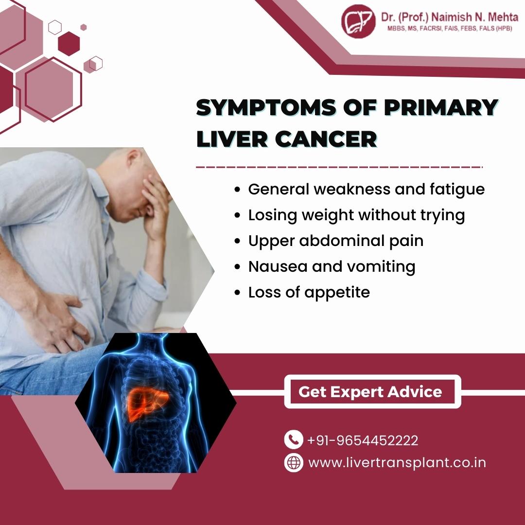 mehta_naimish's tweet image. Symptoms of Primary Liver Cancer
- General weakness and fatigue
- Losing weight without trying
- Upper abdominal pain
- Nausea and vomiting
- Loss of appetite

#livercancer #liverproblem #liverdisease #liverpain #liverdoctor #DrNaimishMehta