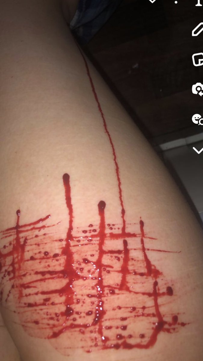 cutmelol's tweet photo. hi

shtwt ouchietwt beanstwt goretwt bloodtwt obslovetwt 198twt raspberryfillingtwt armgillstwt https://t.co/UnjZwRsuX7