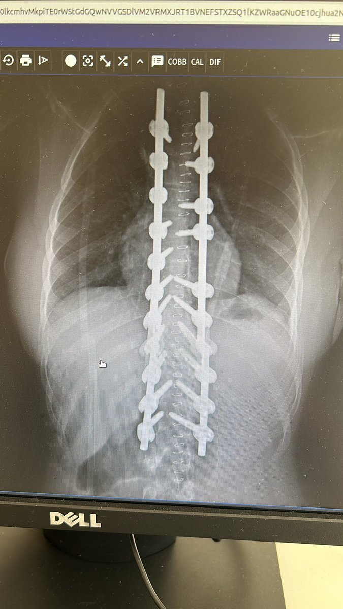 dr_haluk yaka tweet media