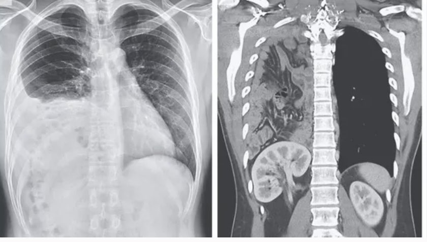 Oren Gottfried, MD tweet media