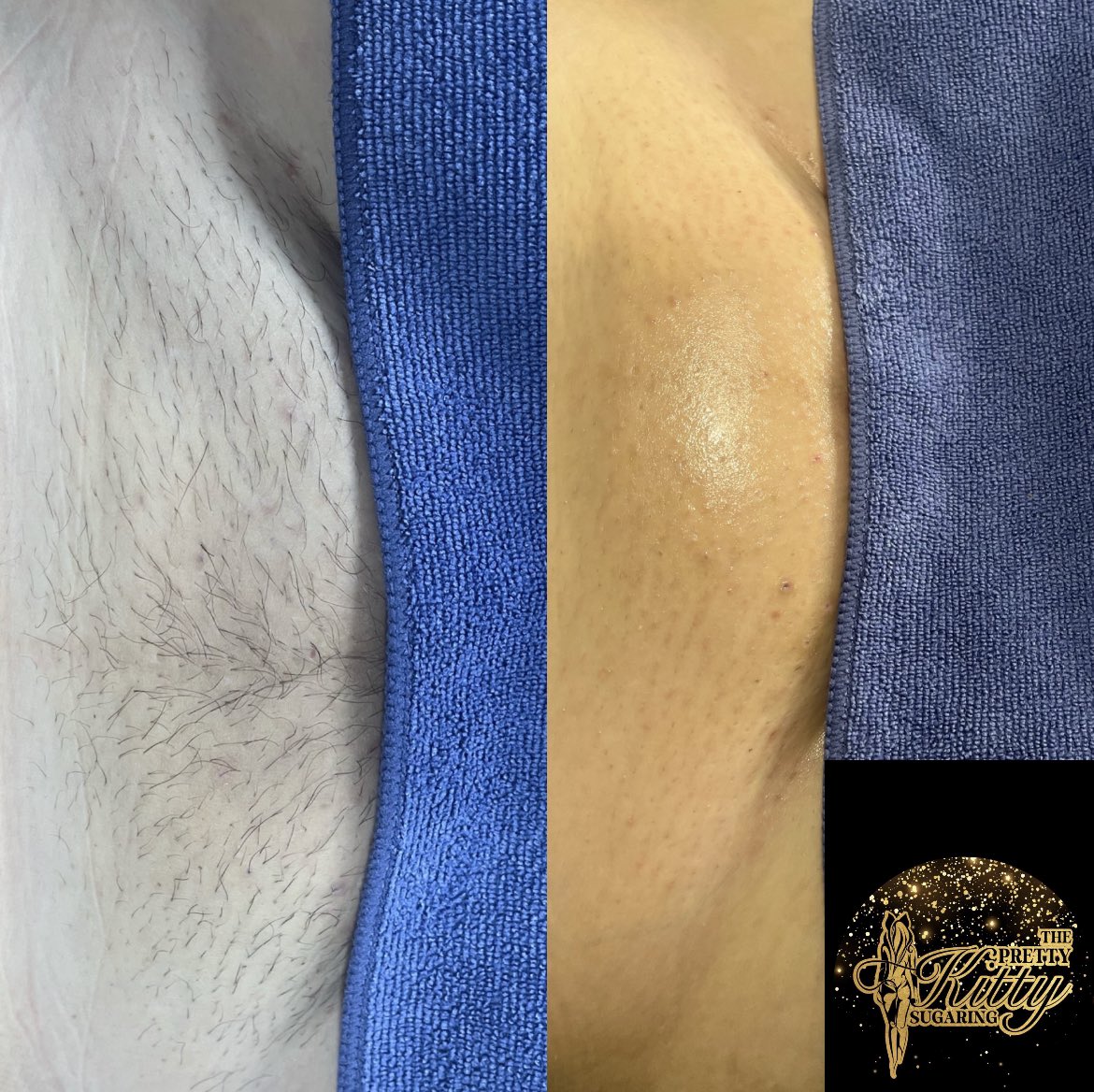 Thepk_sugaring's tweet photo. Regularly monthly sugar client ✨ 

Sugaring is done every 4 weeks after initial appointment to allow all the hairs to grow out of the skin and be removed at the same rate for a more smooth after 😻

#TheGlowUpSalonAndSugarSpa https://t.co/iWgz3GfIvg