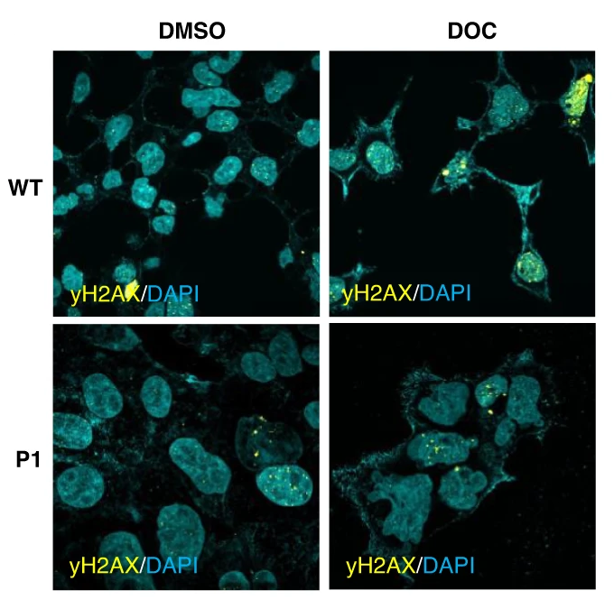 Prostate Cell News (@prostatecell) on Twitter photo 💡 PDE4D7 is a vital modulator of cAMP signaling in prostate cancer cells.
Scientists led by <a href="/ChloeGulliver/">Chloé Gulliver</a> at <a href="/UofGlasgow/">University of Glasgow</a> provide insight into the regulatory role of PDE4D7 in the development of lethal prostate cancer.
Learn more at <a href="/BrJCancer/">British Journal of Cancer</a>:
📑 go.nature.com/48BDCEw 💡 PDE4D7 is a vital modulator of cAMP signaling in prostate cancer cells.
Scientists led by <a href="/ChloeGulliver/">Chloé Gulliver</a> at <a href="/UofGlasgow/">University of Glasgow</a> provide insight into the regulatory role of PDE4D7 in the development of lethal prostate cancer.
Learn more at <a href="/BrJCancer/">British Journal of Cancer</a>:
📑 go.nature.com/48BDCEw