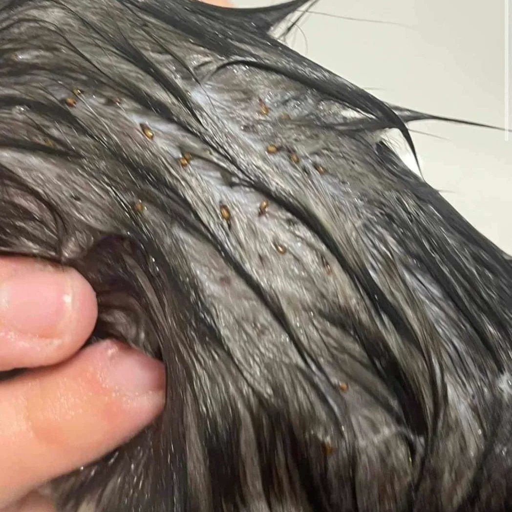 StrayCatsWM's tweet photo. 🆘 KITTEN TURNING BLUE 💔 I WANT TO CRY………CRITICAL KITTEN JUST BEEN TAKEN TO WILLOWS REFERRAL CENTRE 🆘🆘🆘

Found a few hours ago on the streets of Birmingham, a six week old semi conscious kitten has the worst case of flea anaemia we have seen. https://t.co/zRE8ANc6rm
