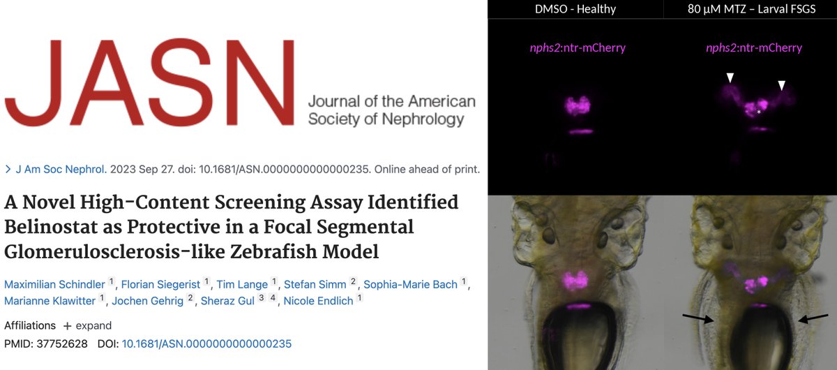 Great moment to announce our JASN paper.🙏 to my postdoc Maximillian Schindler for pioneering our zebrafish larval screening method. We discovered compounds that reduce kidney damage in an FSGS-like model. We will translate these findings for FSGS patient! Looking for investors!
