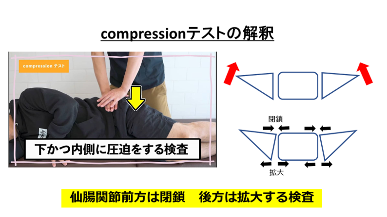 miya366494678's tweet photo. 仙腸関節のテストはいくつかありますが、どのテストが陽性であるかで解釈が変わります
例えばdistractionテストは仙腸関節前方を拡大し、後方を閉鎖する検査です
その為、陽性であった場合は前方は締めて後方は緩める治療が良いのかもと考えられます
compressionテストは逆となります https://t.co/xKwRJgGARX