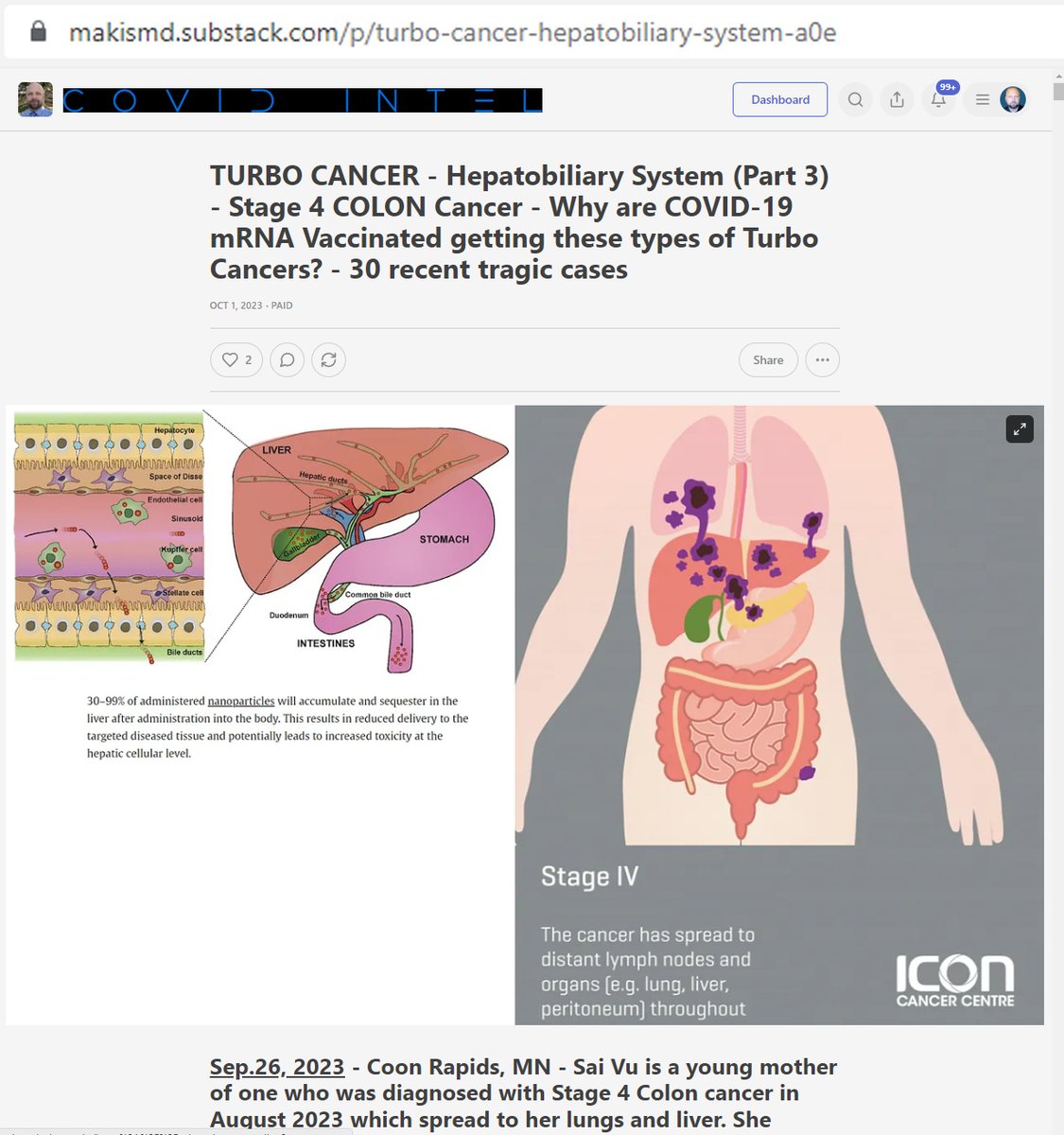 NEW ARTICLE: TURBO CANCER - Stage 4 COLON Cancer - Why are COVID-19 mRNA Vaccinated getting these types of Turbo Cancers? 

There is a Tsunami of Stage 4 COLON Turbo Cancers being diagnosed RIGHT NOW in PFIZER and MODERNA mRNA Vaccinated people in their 20s, 30s, 40s, 50s: