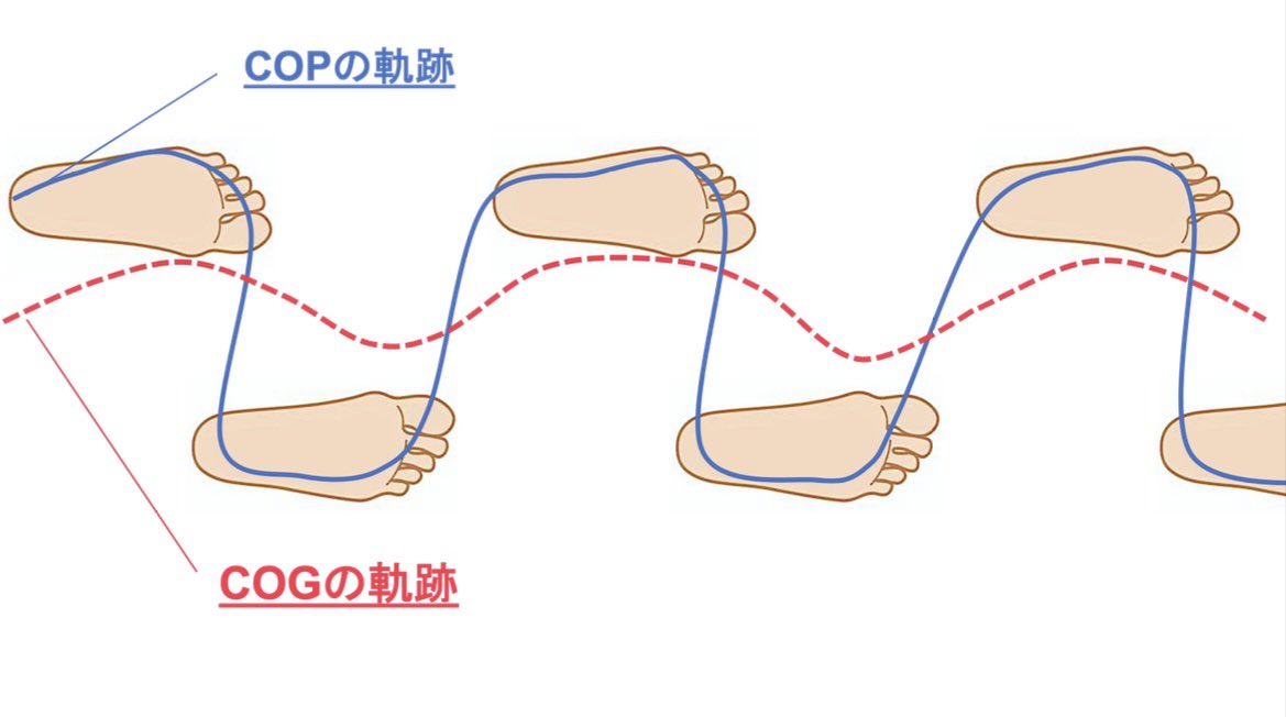 oshiroakito's tweet photo. COGとCOP🦶

これ、ごっちゃになってる
人めちゃくちゃ多い印象。

COP→床反力作用点
COG→身体重心位置

よく見る、足底の外側を通って
母趾に抜けていく...ってやつはCOP。

COGは歩行中はむしろ
支持基底面には入りません！

#インソール作成には必須知識
#COG無駄に動かさないのが効率歩行 https://t.co/yVrz4iEL3k