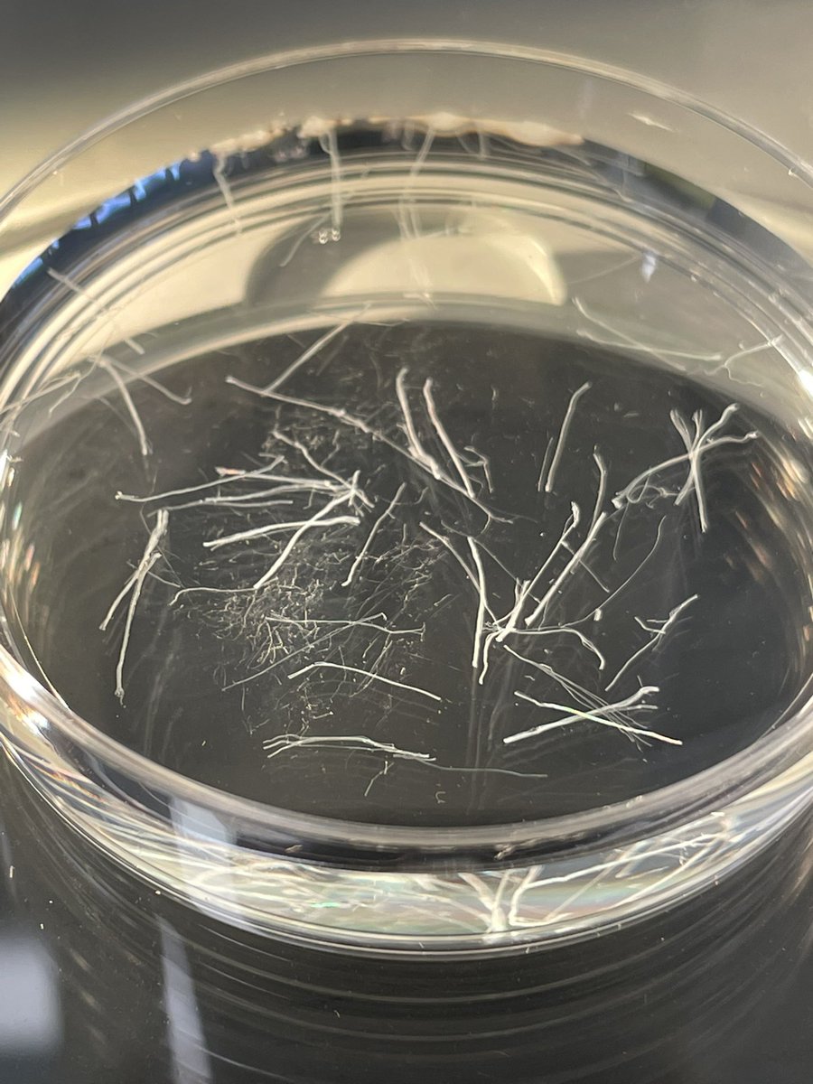 Emma Helene Frank Larsen (@emmafrank96) on Twitter photo During today’s dissecting of muscle fibers from cancer patients I again realized what heroes they are. Being behind the lines I sometimes forget. Thank <a href="/JonasSr25079334/">Jonas Sørensen</a> for doing this important study. During today’s dissecting of muscle fibers from cancer patients I again realized what heroes they are. Being behind the lines I sometimes forget. Thank <a href="/JonasSr25079334/">Jonas Sørensen</a> for doing this important study.