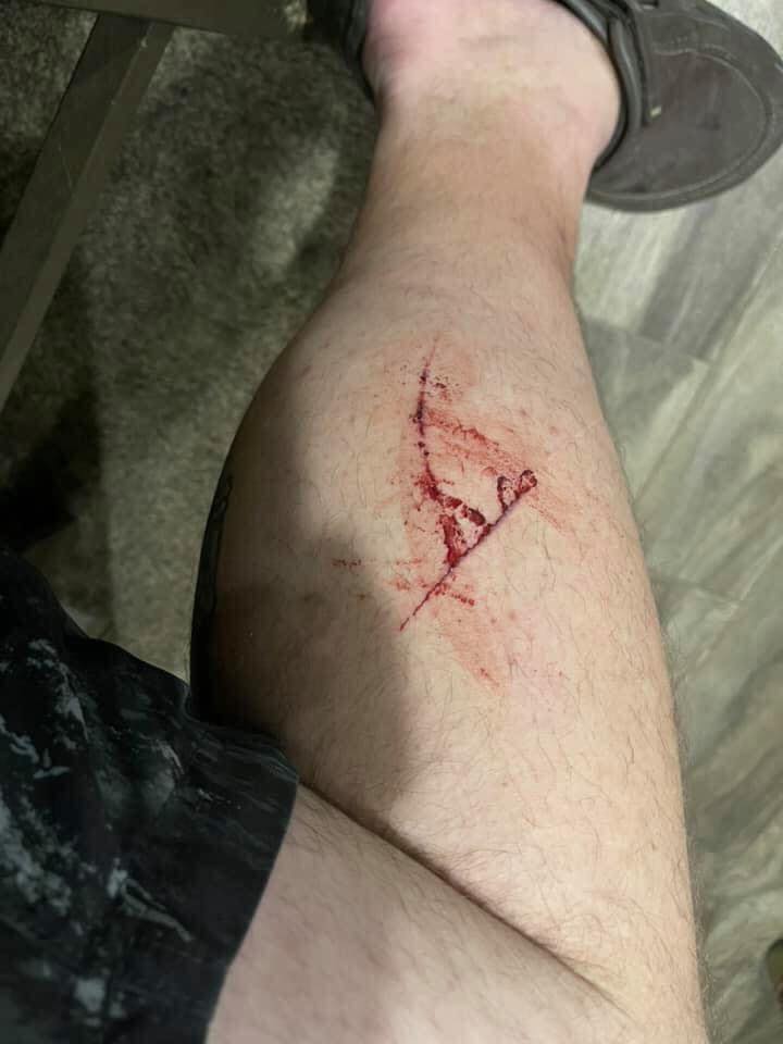 Well Ruger saved me a hospital trip maybe even my life. He has never bitten me beside playing but today while walking the lake as we always do he became pretty aggressive nipping at me then wrapped my leg and his dew claws really dig in I turned to scold him and he ran around me