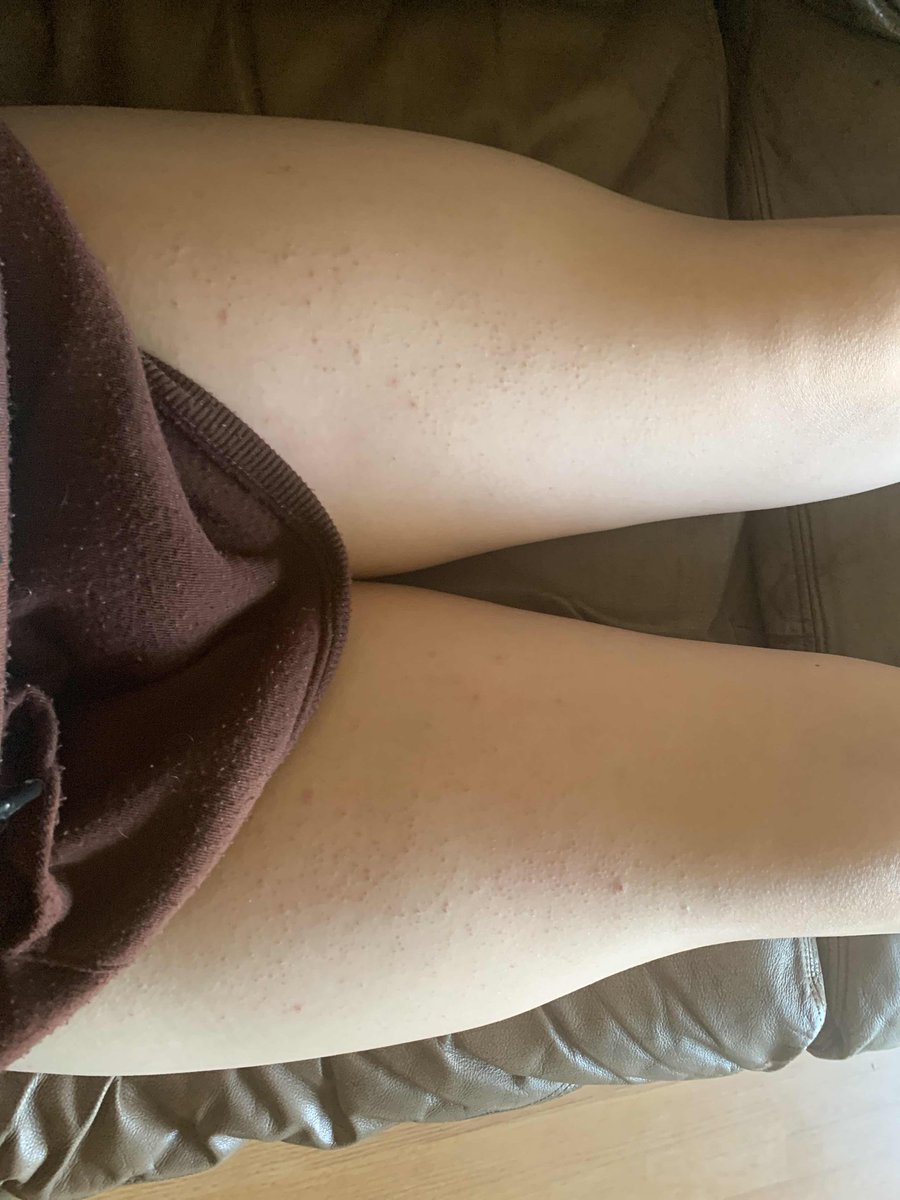 Diztraint's tweet photo. honestly, even I was counting on big ones.. #Femboy #legs #thigs https://t.co/i7yVY5U8XW