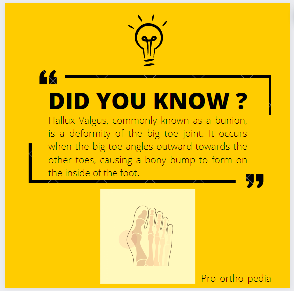 Knowledge967192's tweet image. Did you know about Hallux Valgus? It's a common foot condition where the big toe deviates towards the other toes. This can cause discomfort and affect your mobility. #patholo #FootHealth #Podiatry #Orthopedics #HealthAwareness"