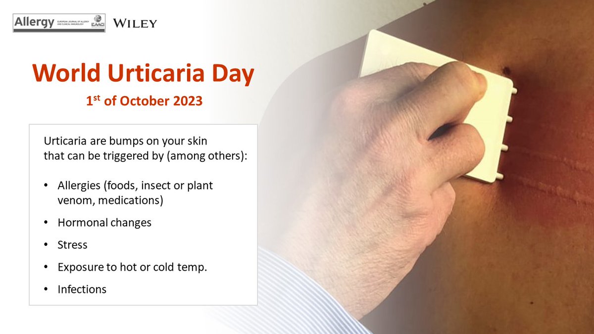 Today is World Urticaria Day Urticaria is a skin condition that currently affects 20% of the population at some point in their lives. As part of #WorldUrticariaDay, celebrated on the 1st of October, we highlight research articles published in #Allergy on the cellular and…