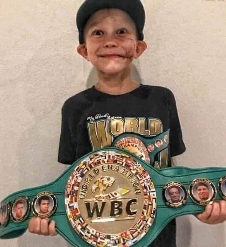 riverolavic's tweet photo. Impacto

El cinturón más merecido de la historia del Consejo Mundial del Boxeo (WBC) fue entregado a Bridger Walker, el pequeño de 6 años, de Illinois, EEUU,  que había rescatado a su hermanita del ataque de un perro pastor alemán. Tenía 90 puntos en todo su cuerpo, pero salvó a su hermana de cuatro años de una muerte segura. Posteriormente declaró: ′′Si alguien tiene que morir sería yo, soy el hermano mayor ′′.
El Consejo Mundial de Boxeo lo reconoció como un campeón mundial de tiempo completo. 
Tiene el récord histórico oficial de WBC.