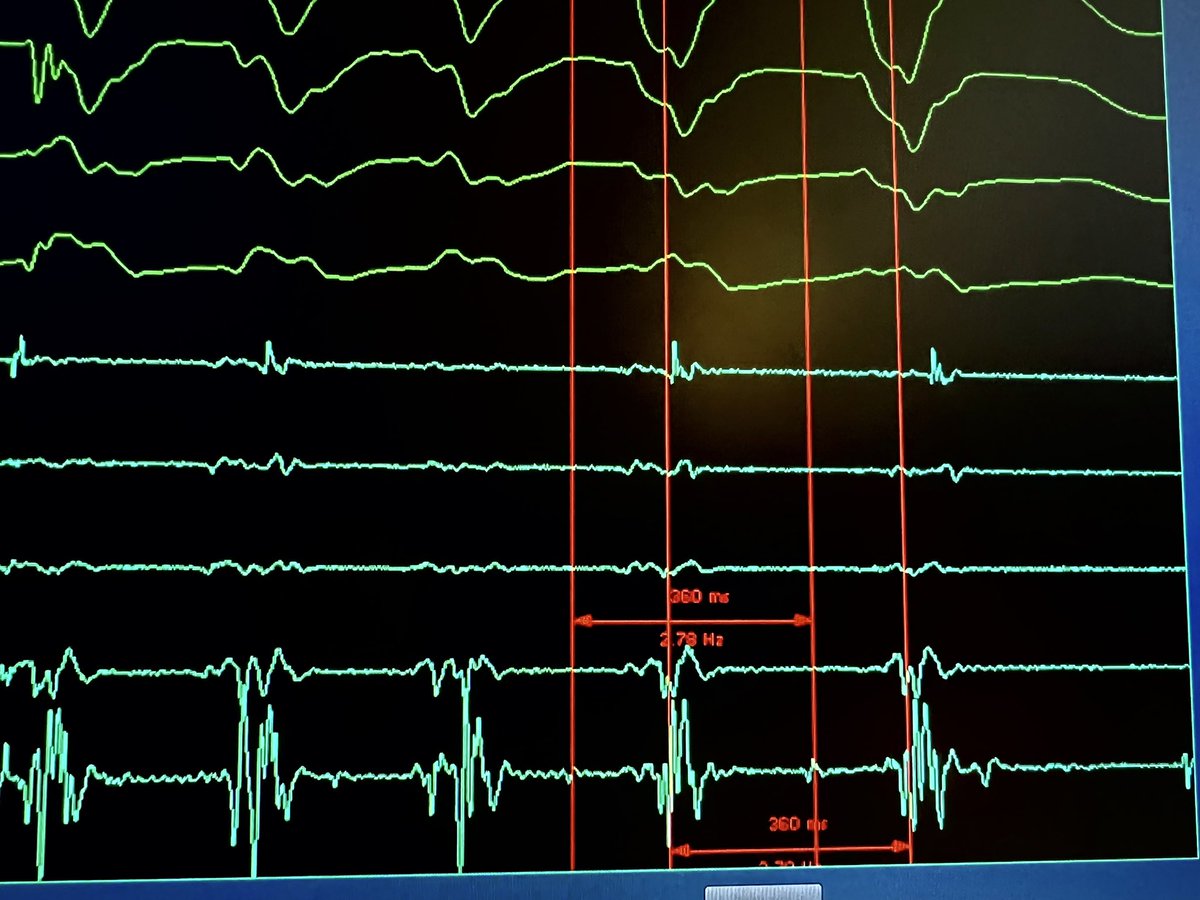 Jason Clark tweet media