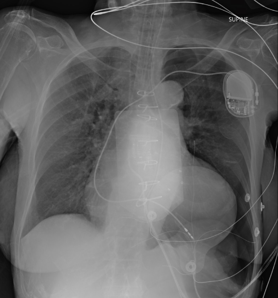 Sam Ghali, M.D. tweet media