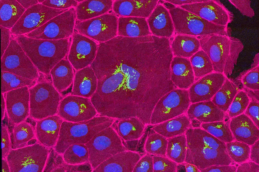newscientist.com/article/239604… #cellscience #celltheraphy 

visit : longdom.org/cell-science-t…