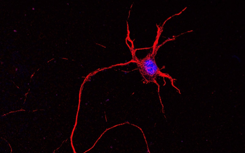 "I would never have done this work if I had not come to UCL and been in this rich environment – clinically and scientifically." Prof Rob Brownstone talks #translation and his his lab’s recent work on the role of the spinal cord in Tor1a dystonia. bit.ly/48FJfla