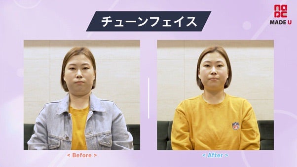 madeujp's tweet photo. 韓国で大活躍の芸人さんが #チューンフェイス 施術を受けにメイドユーにご来院された際に密着しました❤️❤️
✍️ブログを更新しました。見てね😍
https://t.co/fx1fmpAtVm
#メイドユー #ダイエット #ダイエット薬 #韓国ダイエット #MADEU #ダイエット注射 #メシダ薬 #メシダ注射 #肌管理 #韓国肌管理 https://t.co/XhhUpjrfh9