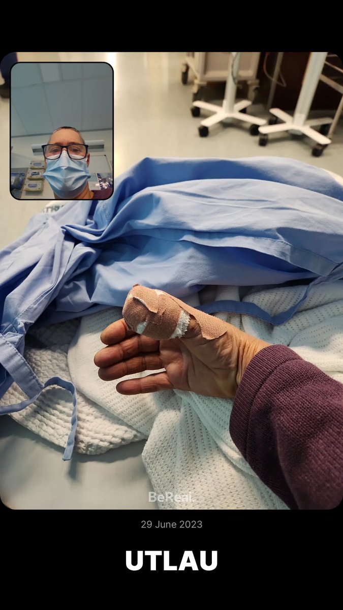 UTLAU's tweet image. Am I the #RealestPersonOnEarth ? :)
Add me on BeReal.
bere.al/utlau
(This was earlier this year when I had surgery to remove a huge splinter from my thumb)