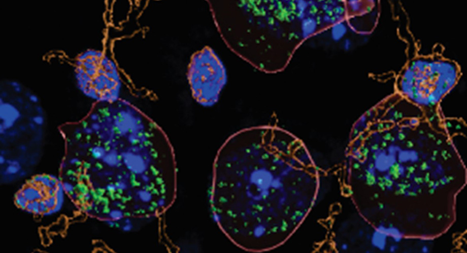 Researchers discovered higher than usual levels of the immune signaling molecule interleukin-1B (green) in neurons (outlined in red) from the brains of alcohol-dependent mice. 

Credit: @scrippsresearch  

#MedTwitter