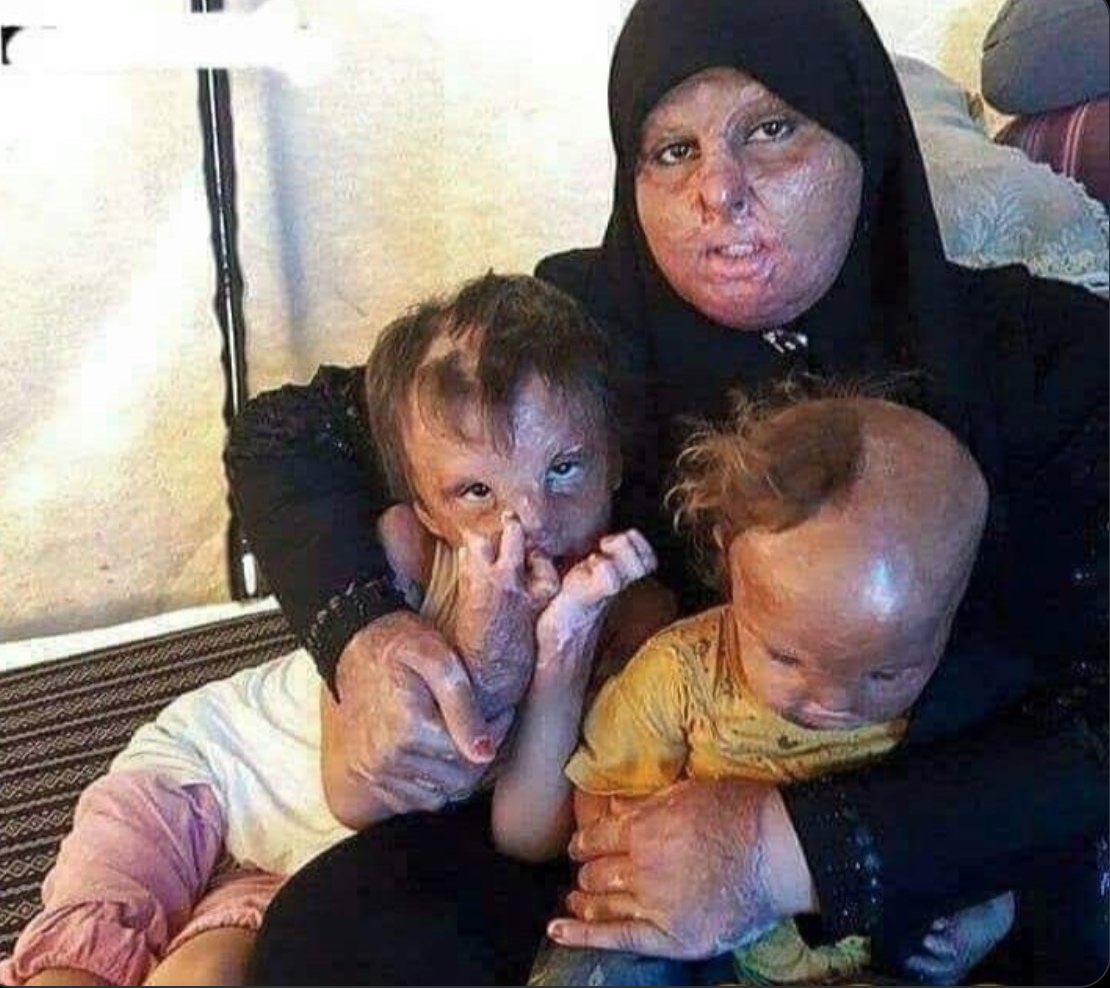 IdrissSihamedi's tweet photo. Le ministre des affaires étrangères israélien déclare : 

« Nous allons finir ces animaux humains »

Images : phosphore blanc utilisé sur les palestiniens ( femmes et enfants, civils ). https://t.co/bIPaTzVXEX