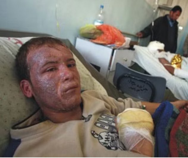 IdrissSihamedi's tweet photo. Le ministre des affaires étrangères israélien déclare : 

« Nous allons finir ces animaux humains »

Images : phosphore blanc utilisé sur les palestiniens ( femmes et enfants, civils ). https://t.co/bIPaTzVXEX
