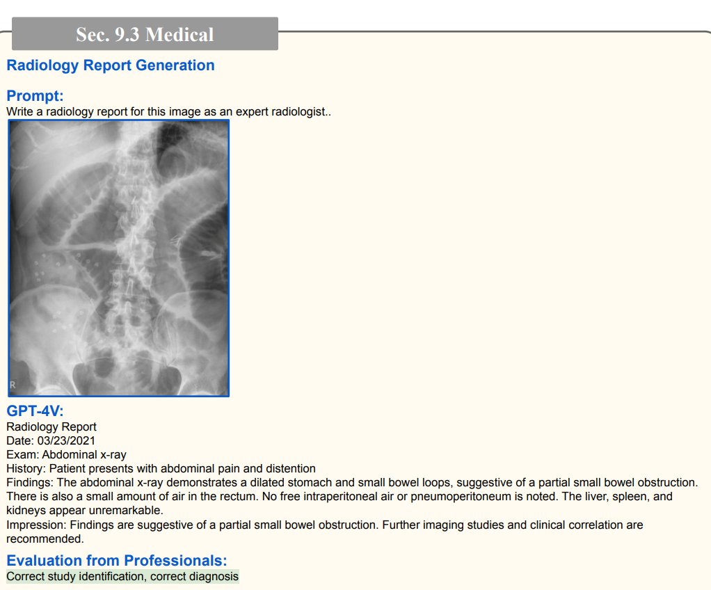 petergyang's tweet photo. Underrated use case of ChatGPT Vision.

It takes 13 years of training to be a radiologist.

Now instead of drafting a report from scratch, they probably just need to review AI's diagnosis. https://t.co/IhQFe98m5q