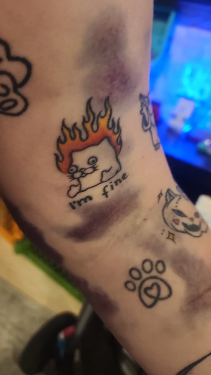 MrsSiqbudz's tweet photo. Story of my life 🙃 #bruisedAF https://t.co/6BoSlIkoD9