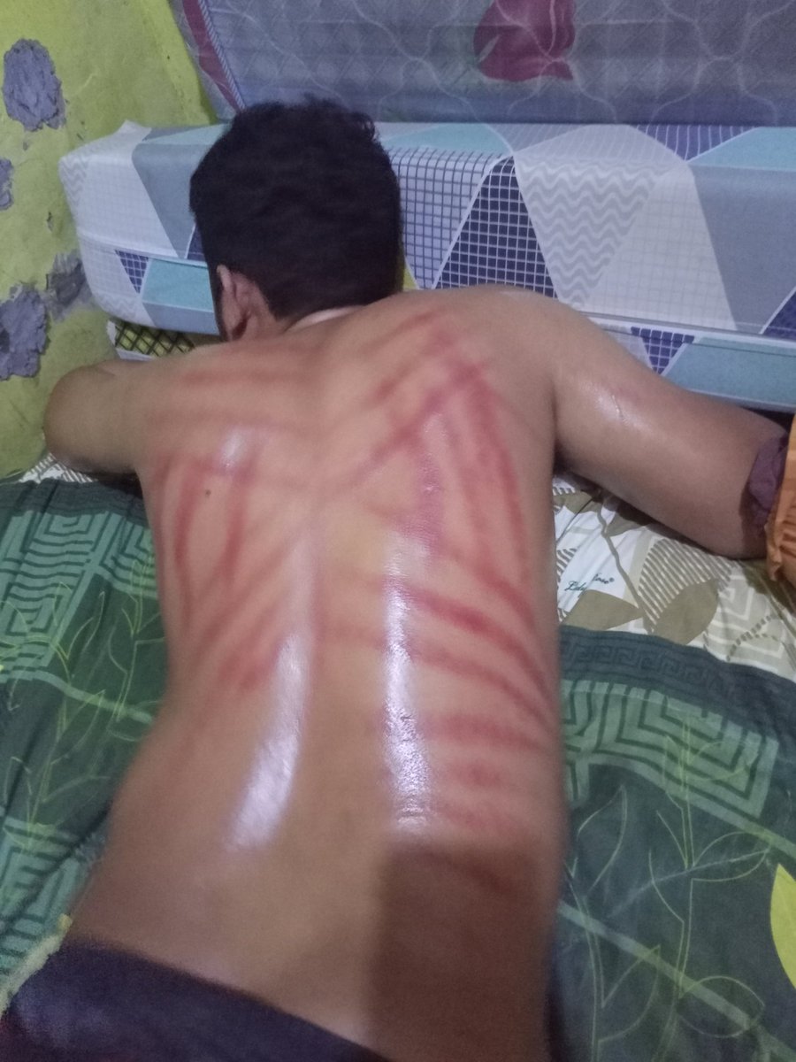 sadis banget kerokannya wkwkwk