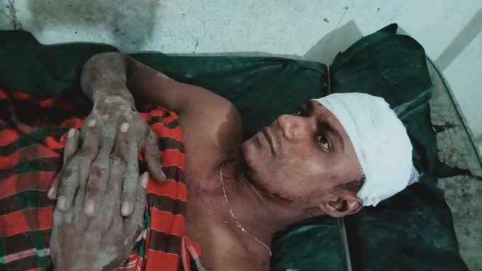 বেনাপোলে আওয়ামীলীগের দু’গ্রুপের সংঘর্ষে ৭ জন আহত