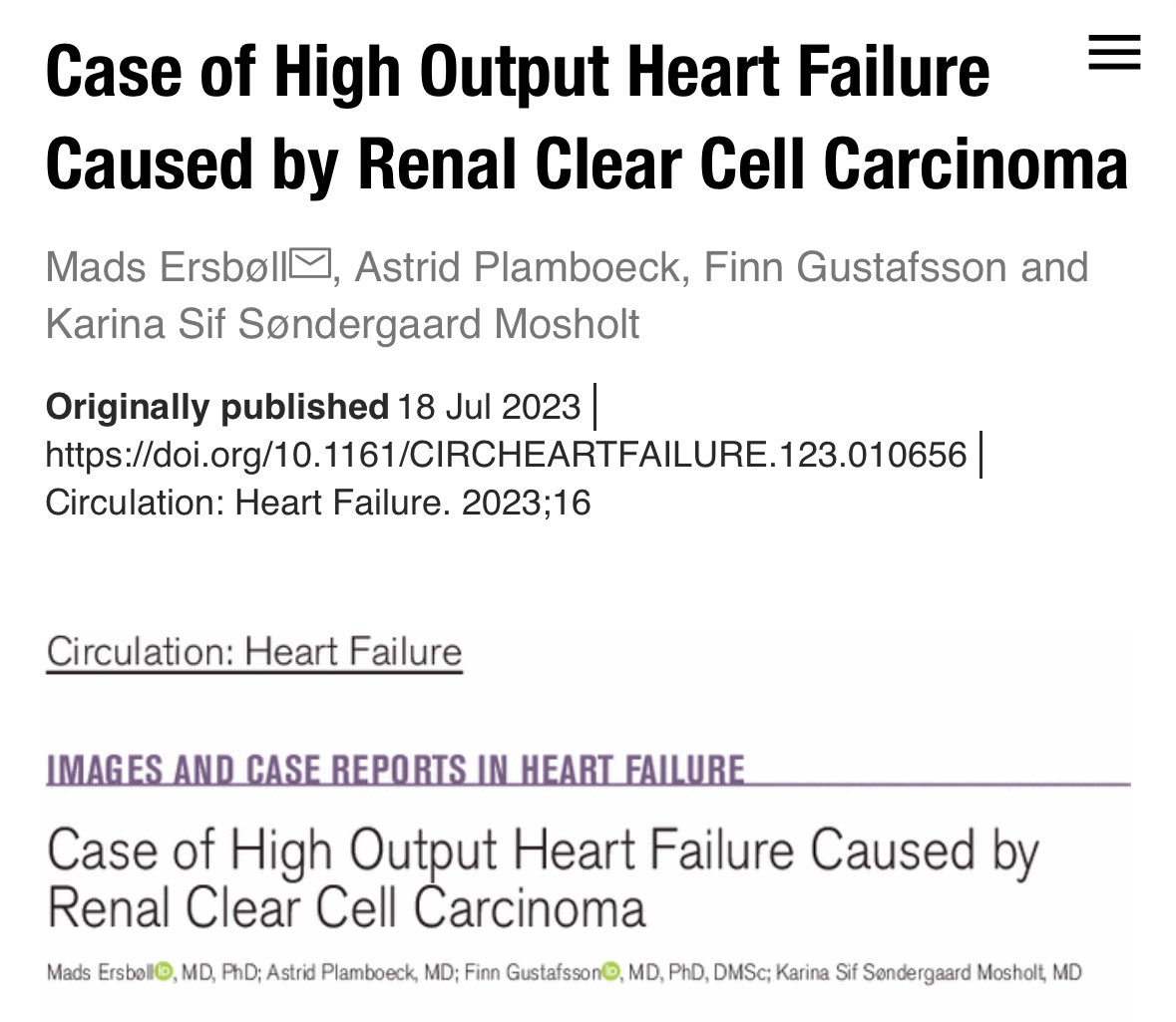 RigsHeart 🫀🚨 (@rigsheart) on Twitter photo Ready for a case report?
In this <a href="/CircHF/">Circ: Heart Failure</a> article the authors <a href="/ersboell_mads/">Mads Kristian Ersbøll</a> <a href="/FinnGustafsson/">Finn Gustafsson</a> et al. present a rare case of a 59-year-old female w/ high output #HF caused by a renal clear cell carcinoma 🫀😮💨 one to remember in the diagnostic work-around in this patient group‼️ Ready for a case report?
In this <a href="/CircHF/">Circ: Heart Failure</a> article the authors <a href="/ersboell_mads/">Mads Kristian Ersbøll</a> <a href="/FinnGustafsson/">Finn Gustafsson</a> et al. present a rare case of a 59-year-old female w/ high output #HF caused by a renal clear cell carcinoma 🫀😮💨 one to remember in the diagnostic work-around in this patient group‼️