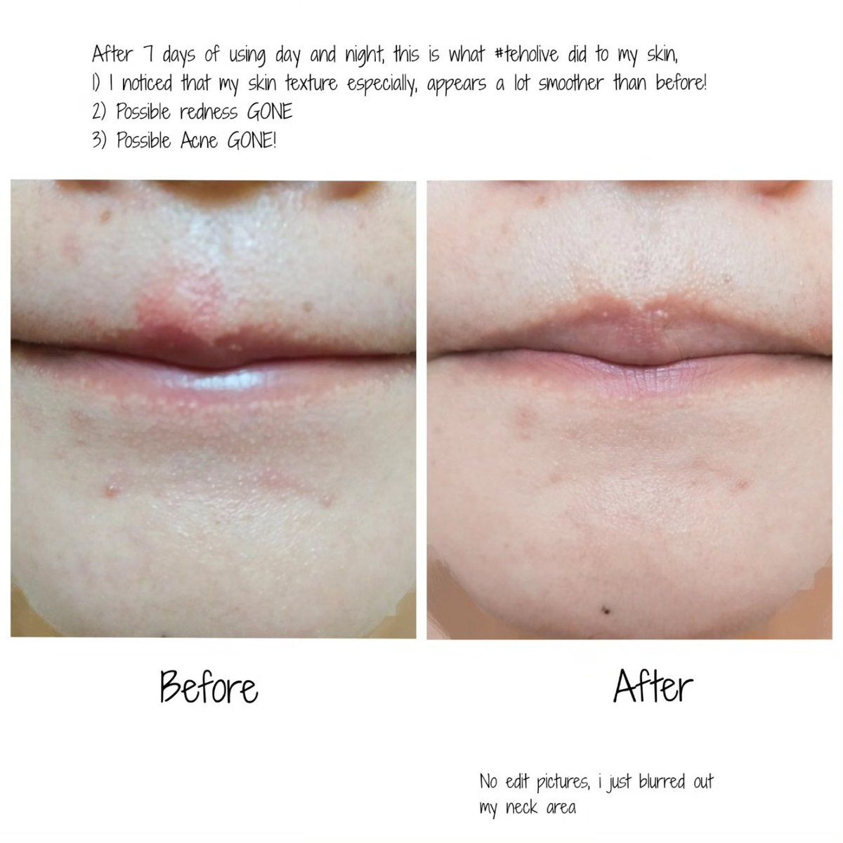 myskinbdA's tweet photo. I tried #teholive from #tatagaltier @tatagaltier tengok sendiri lah result dia on my chin area! 🥺 Auto licin weh 🤍🫶 tak shabarrrr nk grab full size nanti! https://t.co/QgJhSkYH9d