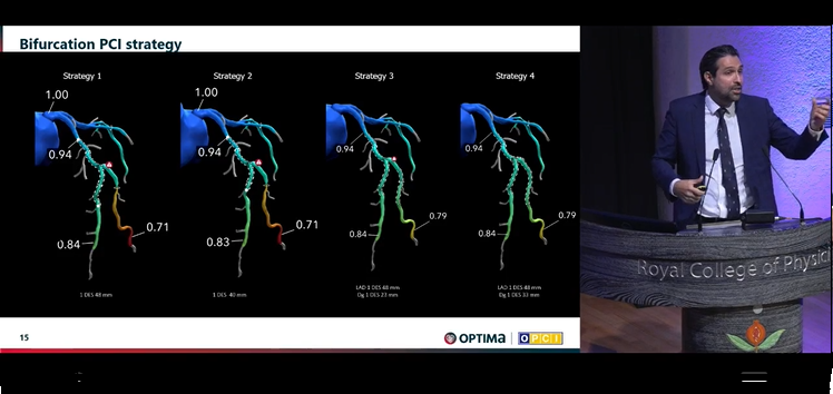 Zill_cardio's tweet photo. Excellent overview of the expanding role of CT guidance in
➡️Assessment of calcific lesions
➡️Selection of toolbox in calcific dis
➡️Planning bifurcation strategies
➡️Post CABG Assessment
#OptimalPCI 2023 @OptimaCTO @WondrEvents #CardioTwitter https://t.co/NF1hrKc9AJ