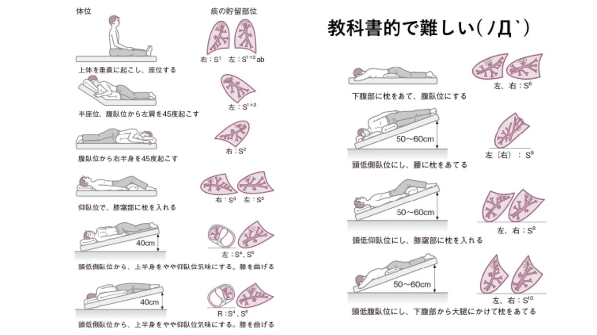koarabook's tweet photo. 適切なポジションニング！！

肺野を覚え聴診できたらやはりちゃんと肺から痰を出したいですよね‼️‼️

下の図を見てできるなら適切なポジションニングを実施しましょ。
難しい姿勢もあるので完璧にとは言えないですが参考になさるのはありかもしれないですね🙌 https://t.co/e0rvfC8P1J