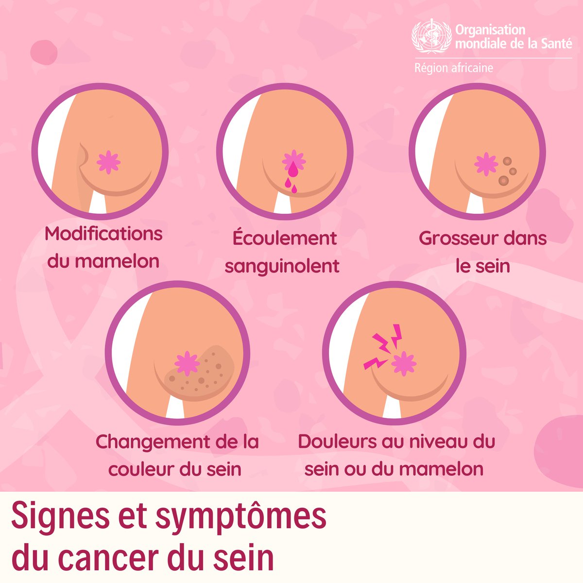 OMSCentrafrique's tweet photo. Octobre : mois de la sensibilisation au cancer du sein

Un diagnostic précoce du cancer du sein augmente généralement les chances de réussite du traitement.   

Si vous remarquez l'un des symptômes ci-dessous, il faut consulter immédiatement un professionnel de la santé. ⬇️ https://t.co/yK2b9BUfNn