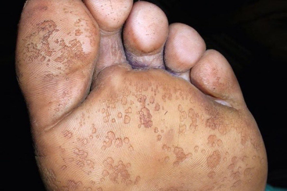 Journal of Brown Hospital Medicine tweet media