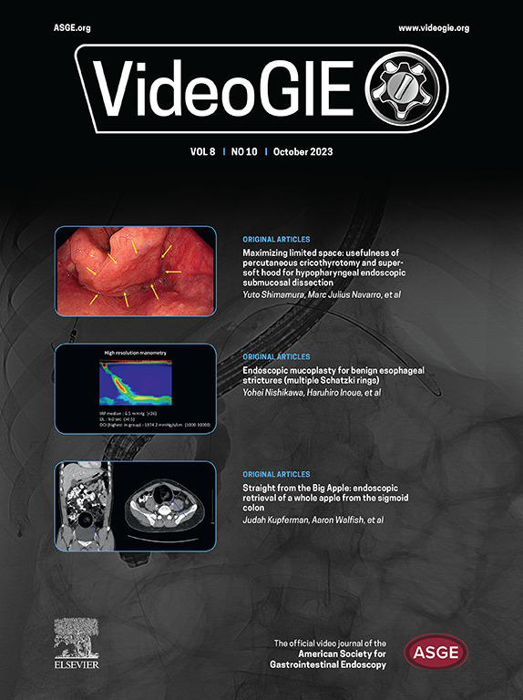 videogie's tweet photo. Check out the October issue of VideoGIE: https://t.co/sNTdAeM4J6

@KaraRaphael https://t.co/HFpDJosjKB