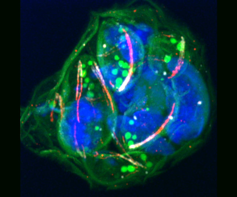 We just submitted a paper showed the disruption of kinetochore proteins affect the karyokinesis and cytokinesis in Plasmodium falciparum. Kinetochore proteins stabilise a nexus between the mitotic apparatus and the apical complex! Followed previous work nature.com/articles/s4146…